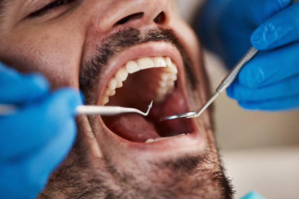 Best Broken Tooth Emergency  in Contra Costa Centre, CA