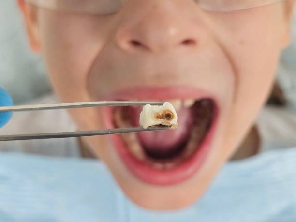 Best Dental Emergency Near Me  in Contra Costa Centre, CA
