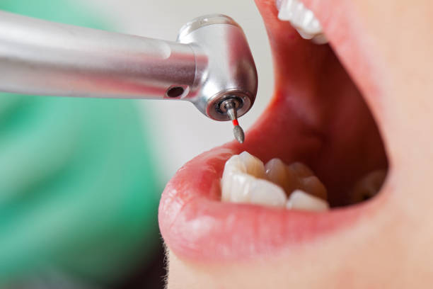 Best Tooth Infection Emergency Dentist  in Contra Costa Centre, CA